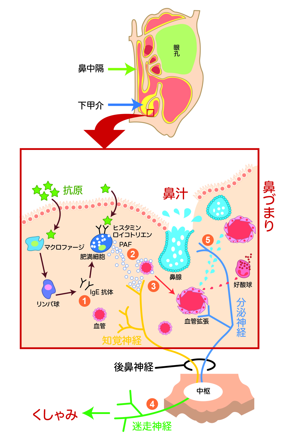 発症する仕組み