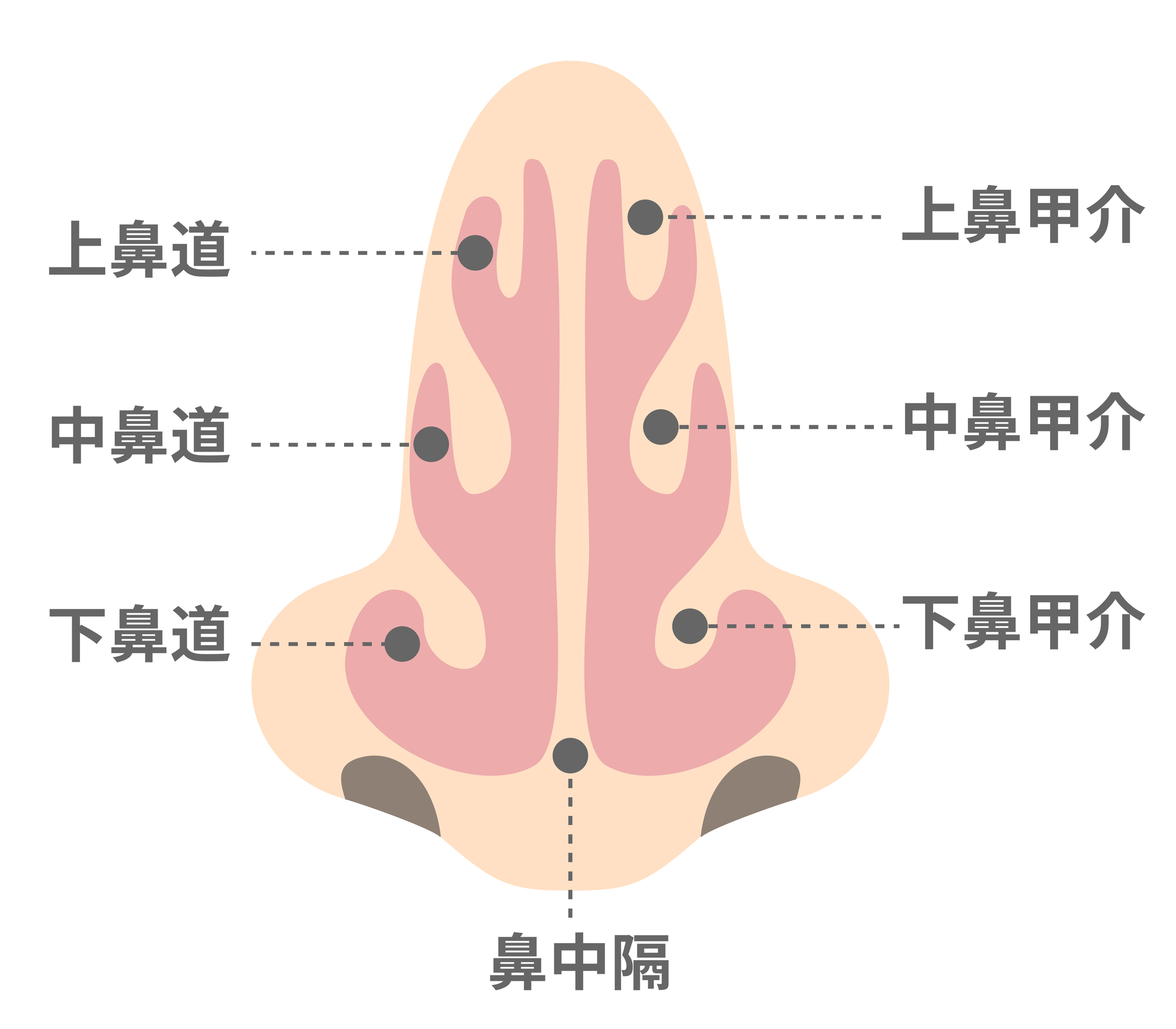 粘膜下下甲介骨切除術