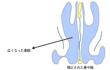 手術後