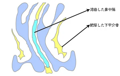 手術前